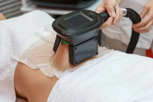 Image of person having fat freezing treatment to help weight gain Scottish