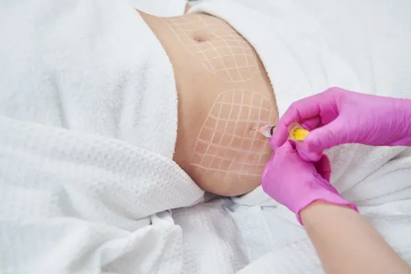 image of fat dissolving injections on love handles to help combat weight gain Scottish
