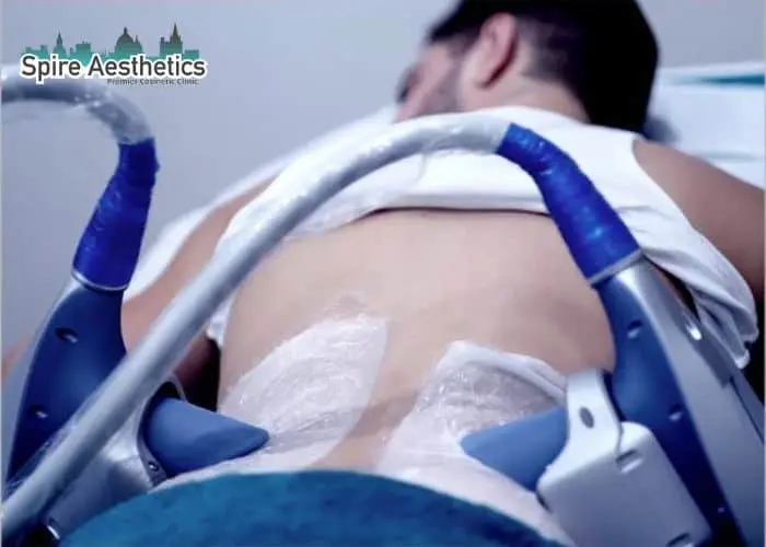 Man having fat freezing treatment done on love handles before a competitions Scottish to create a sculpted look.